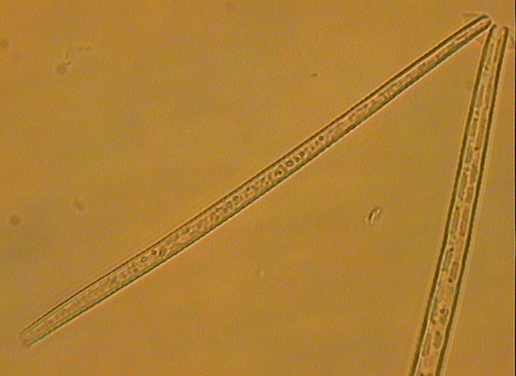 Dictyocha speculum